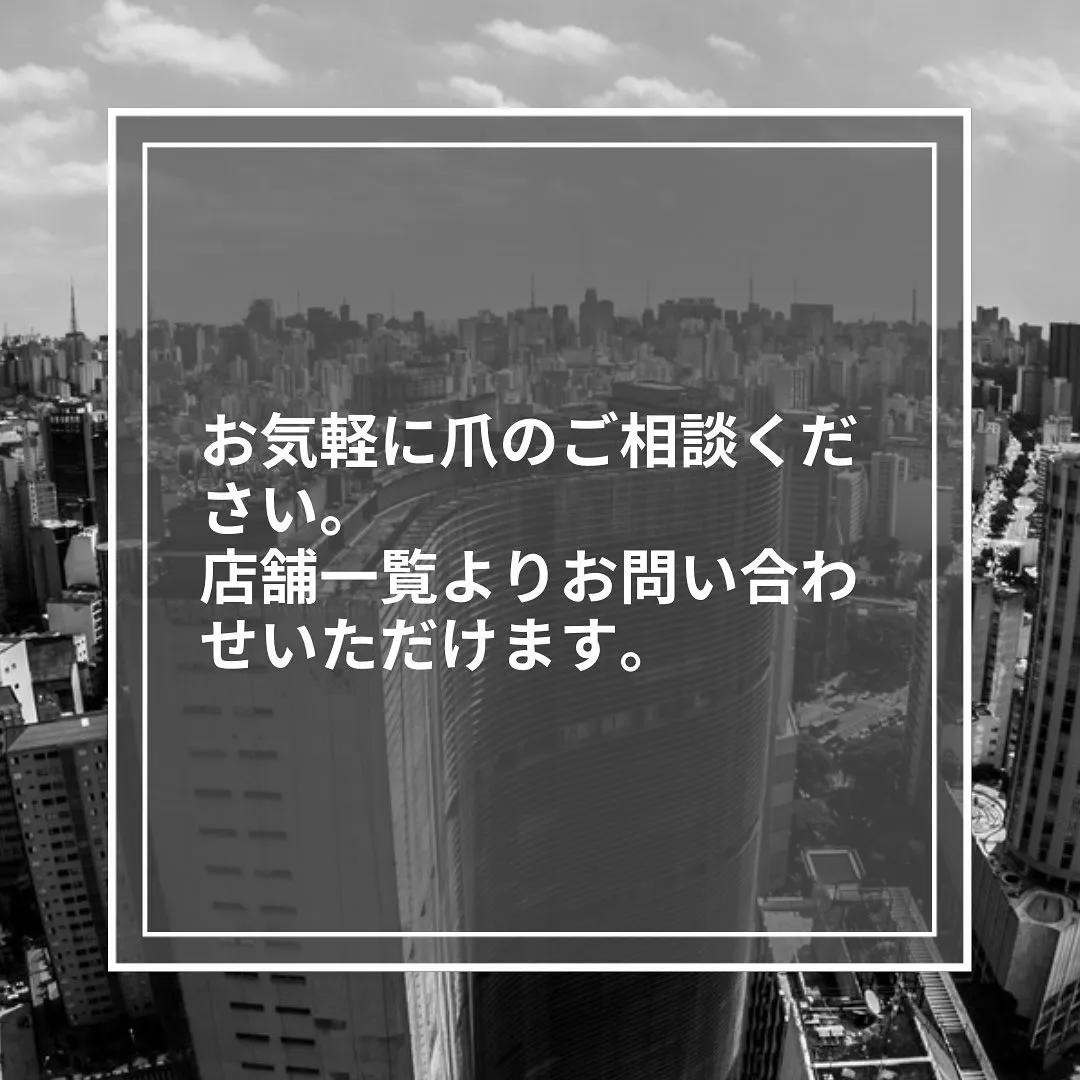 なぜ「ささくれ」が出来るの？