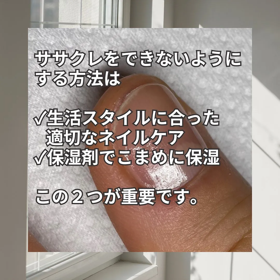 夏も注意！「ささくれ」ができない方法