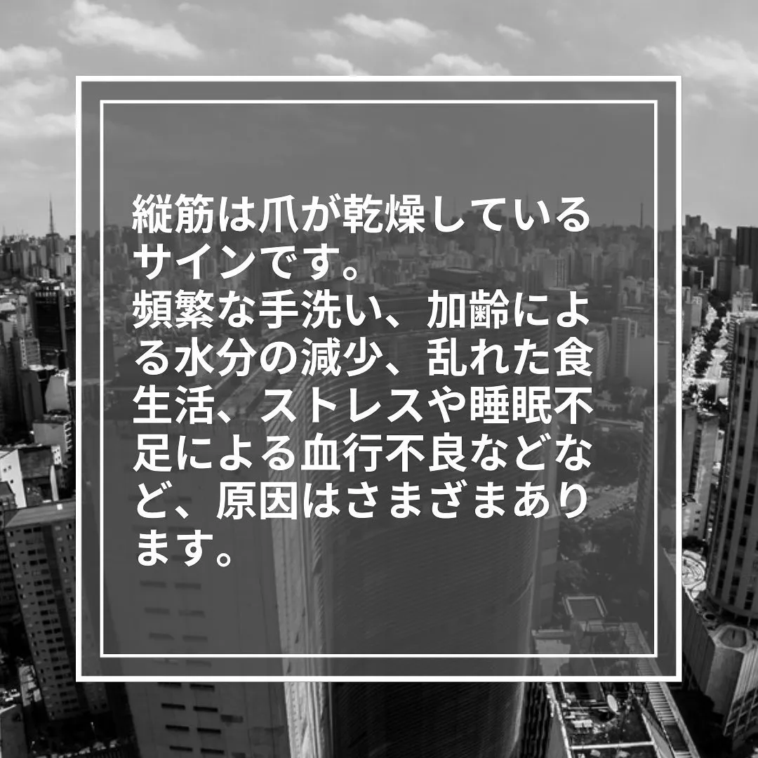 乾燥のサイン！「爪の縦筋」の放置は危険？