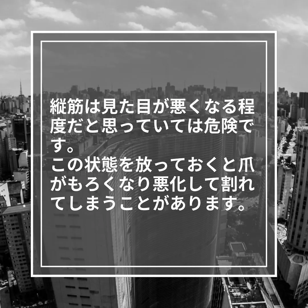 乾燥のサイン！「爪の縦筋」の放置は危険？