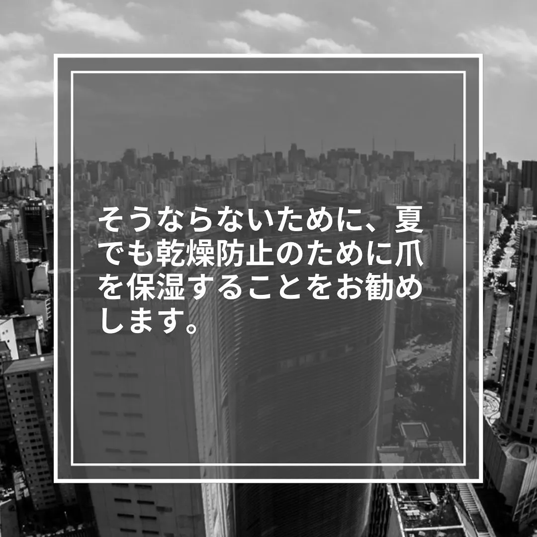 乾燥のサイン！「爪の縦筋」の放置は危険？