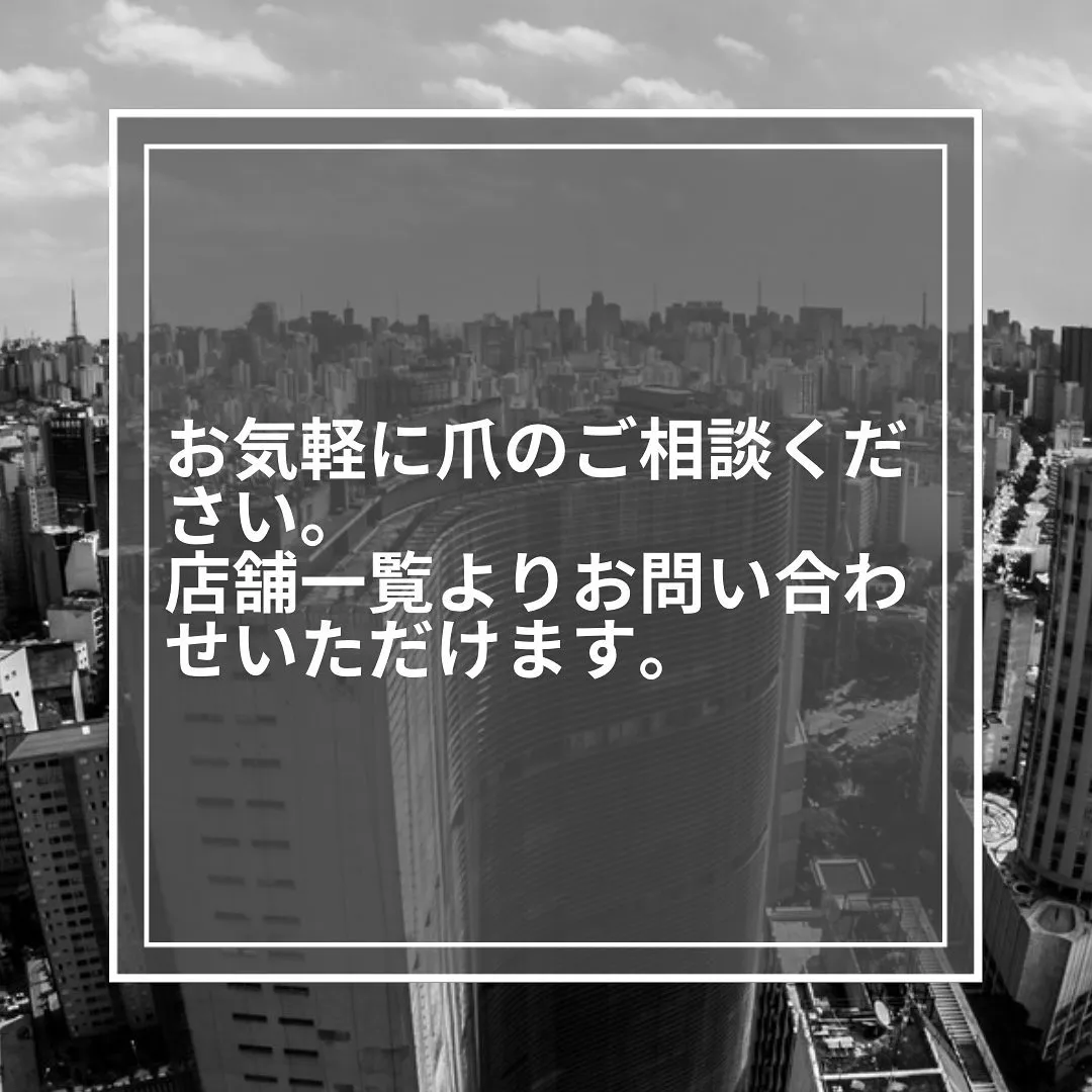 乾燥のサイン！「爪の縦筋」の放置は危険？