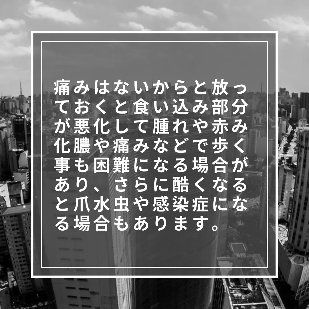 正しく切ろう！巻き爪予防