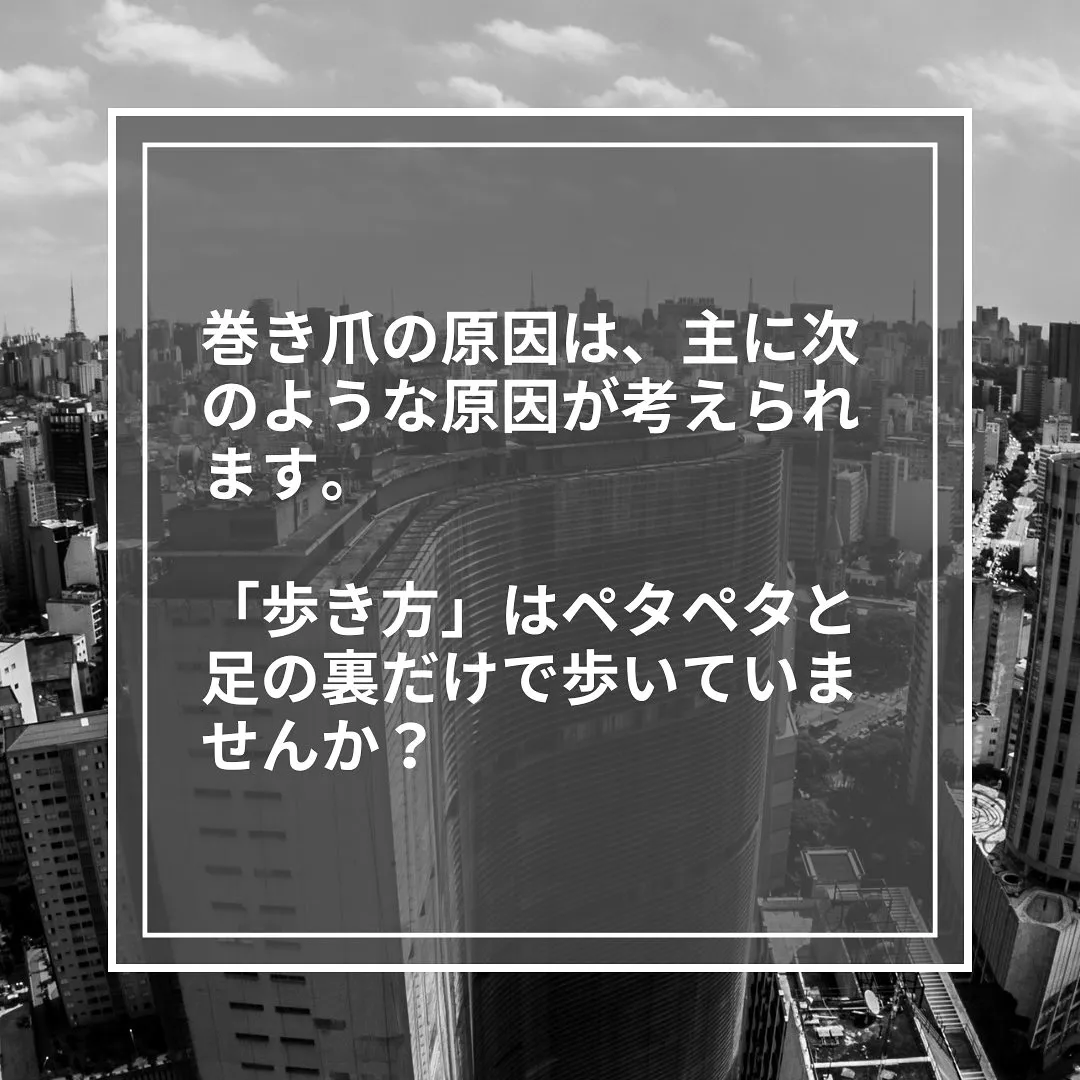 歩き方かも⁈巻き爪の原因