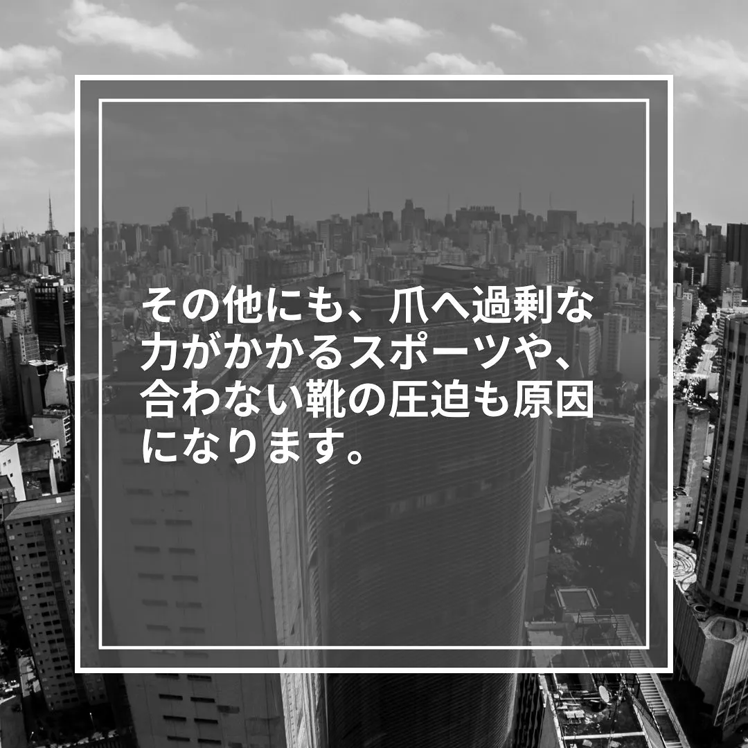 歩き方かも⁈巻き爪の原因