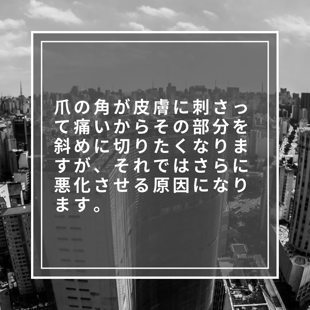 この切り方で巻き爪は痛くならない