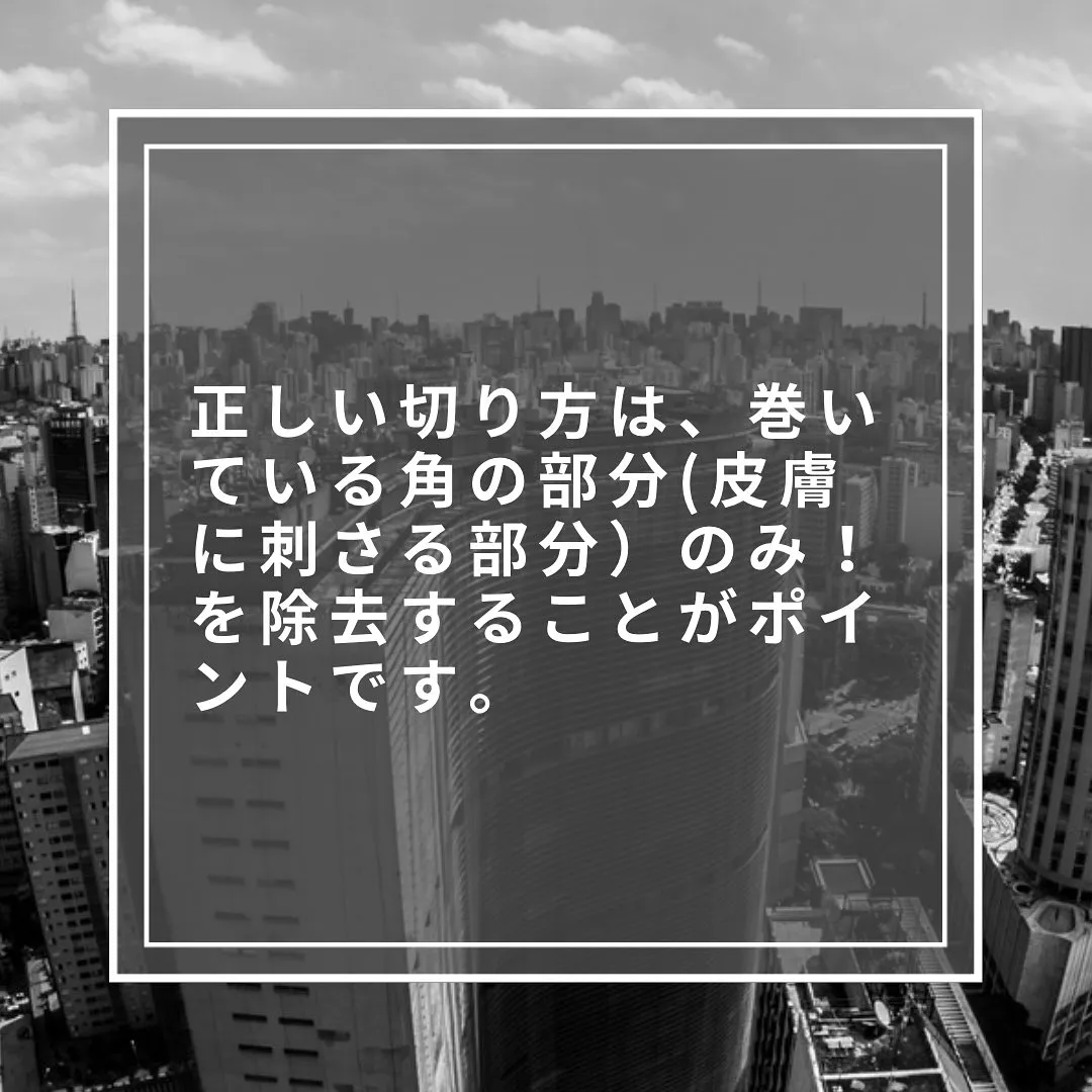 この切り方で巻き爪は痛くならない