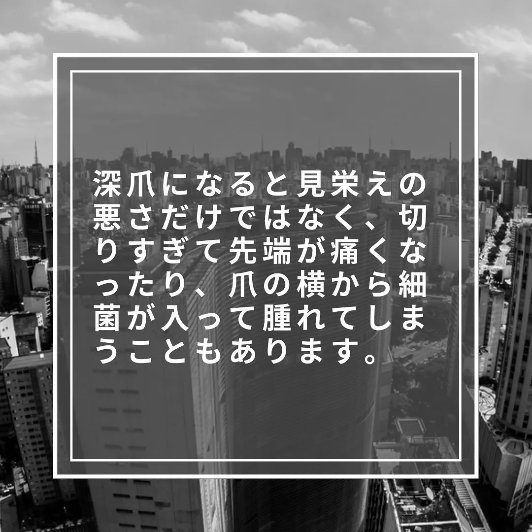 どれくらい爪の白い部分を切ればいい？