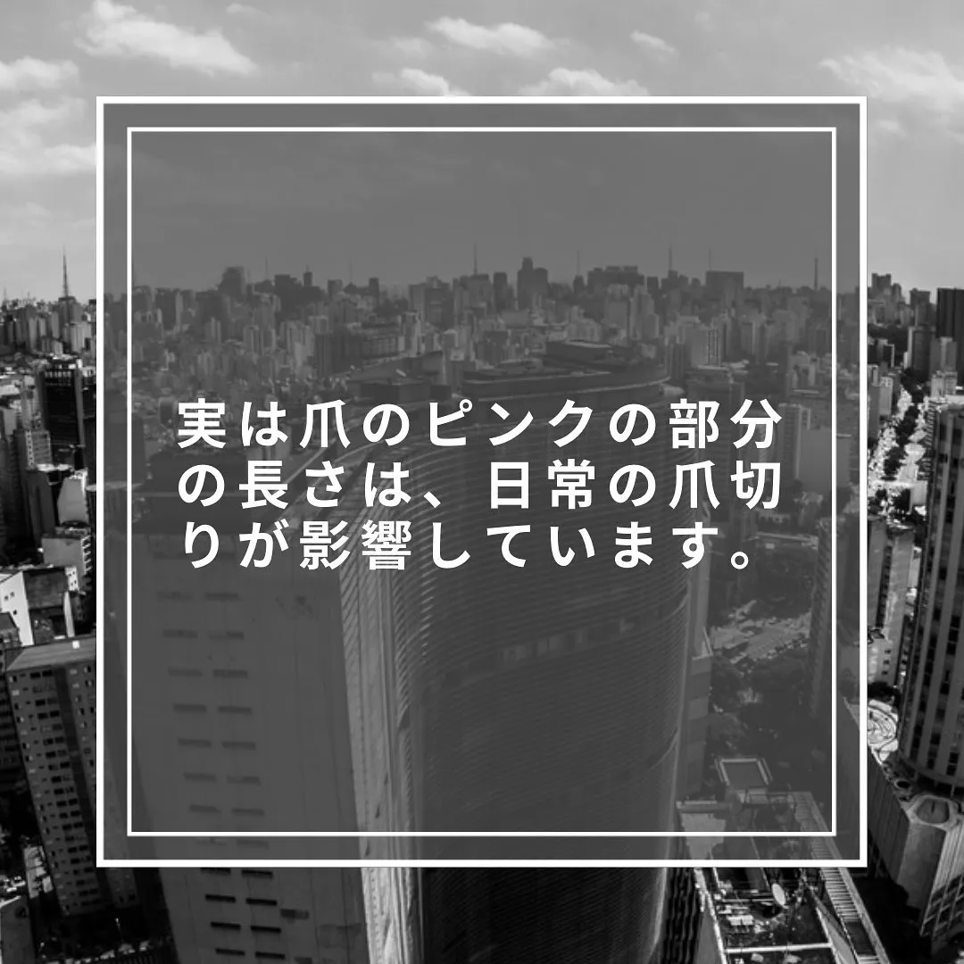 爪のピンクの部分の長さは、生まれつき？