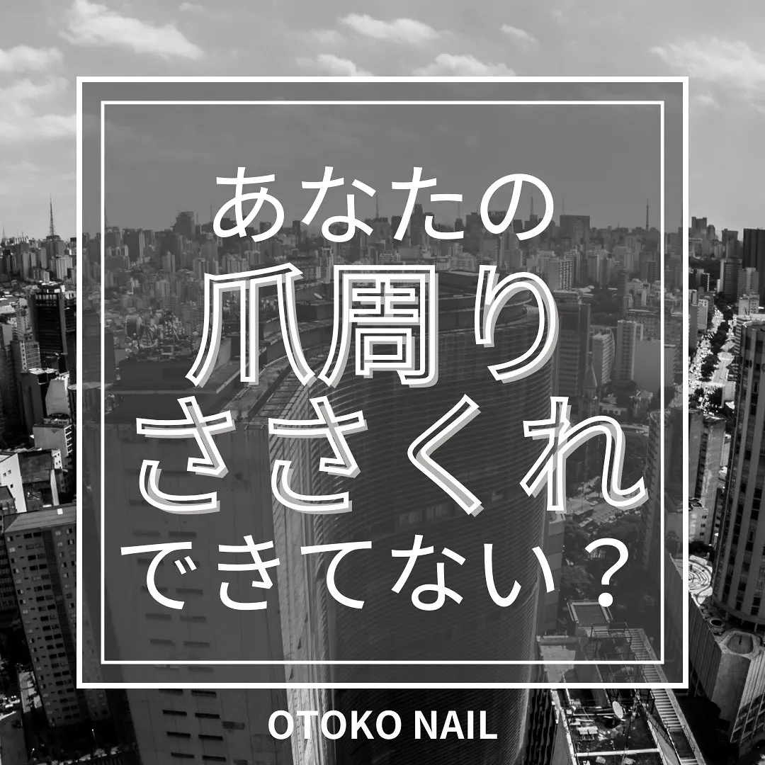 あなたの爪周り、ささくれできてない？