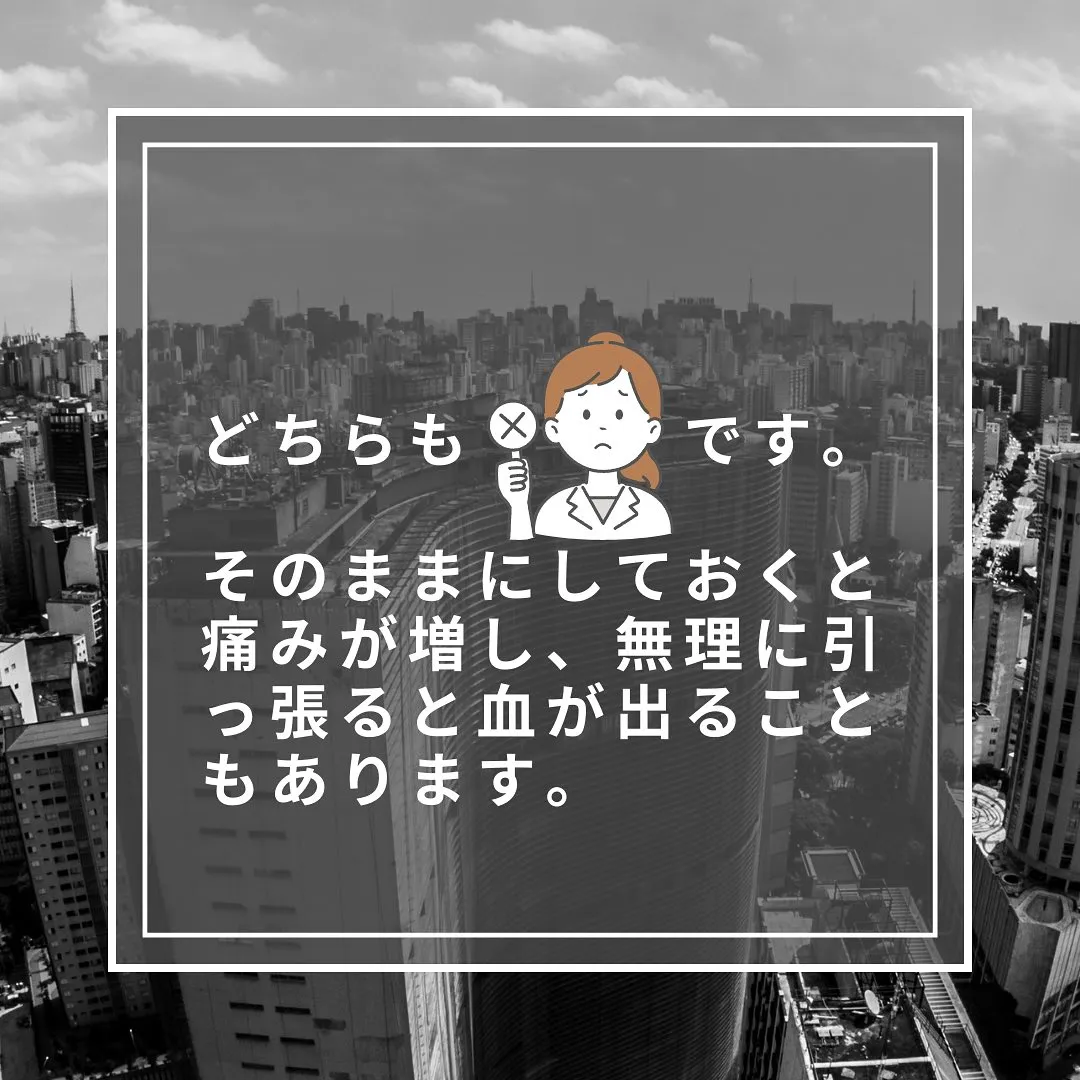 あなたの爪周り、ささくれできてない？