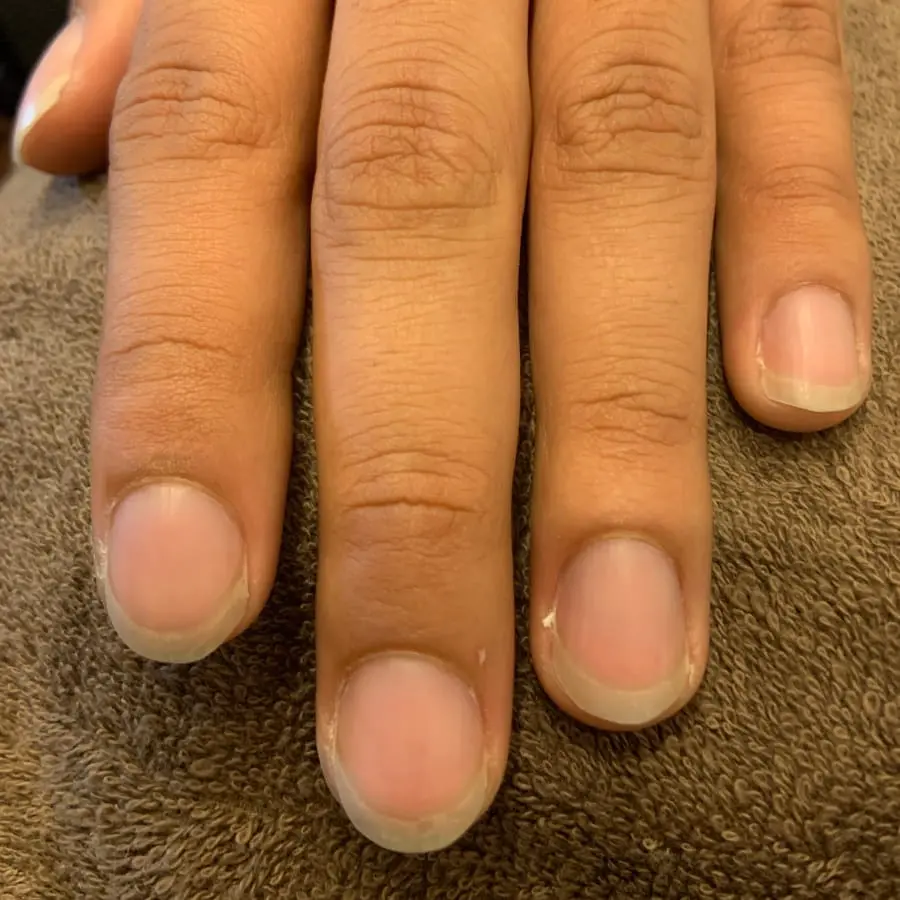 ネイルケア前の男性の手元。爪の表面が乾燥し、ささくれが見られる状態