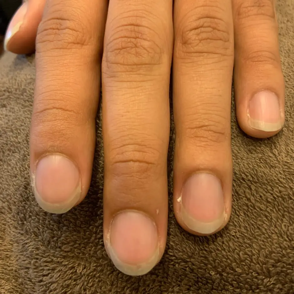 ネイルケア前の男性の手元。爪の表面が乾燥し、ささくれが見られる状態